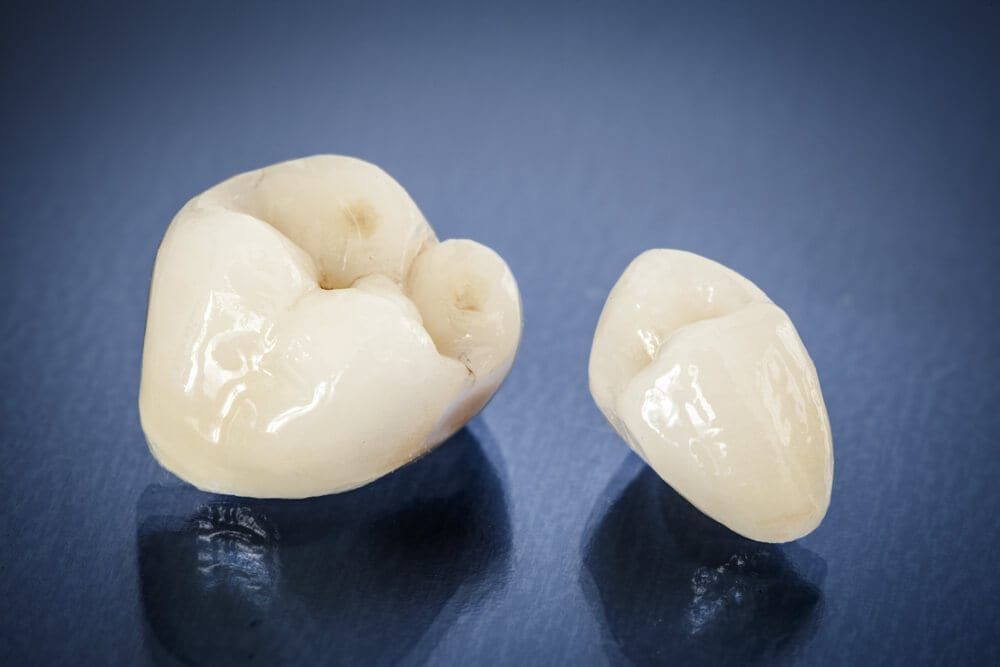 close-up of dental crowns