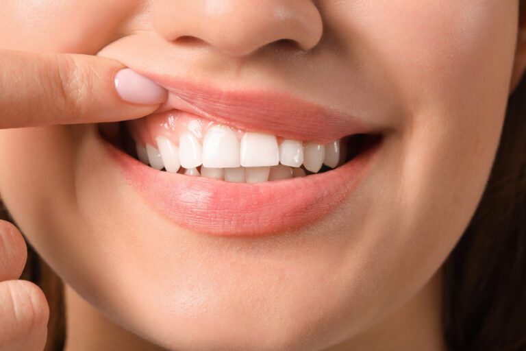 Understanding Gum Health And What Their Color Tells You
