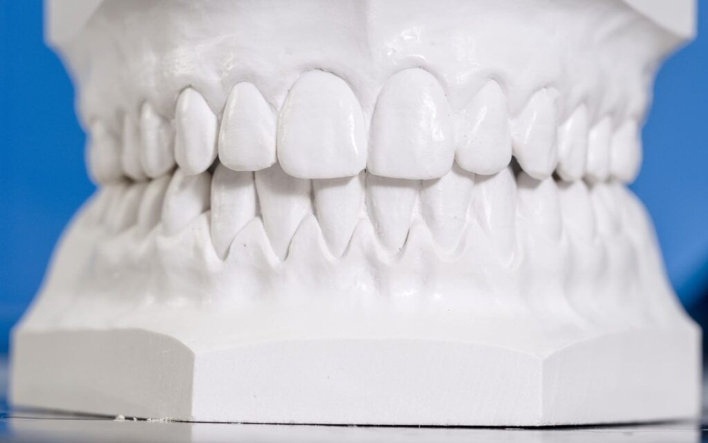 Impression Mold of Teeth
